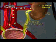 血液循環そのものが体を蝕む悪循環へと変わっていきます。