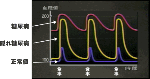 血糖値