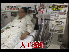 人工透析